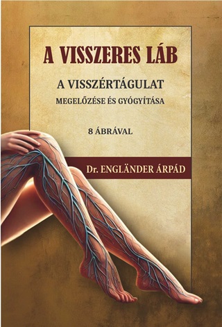 Dr. Englnder rpd - A Visszeres Lb -  A Visszrtgulat Megelzse s Gygytsa